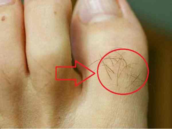 Bí ẩn lông mọc dài ở đâu sẽ mang lại phú quý cả đời?