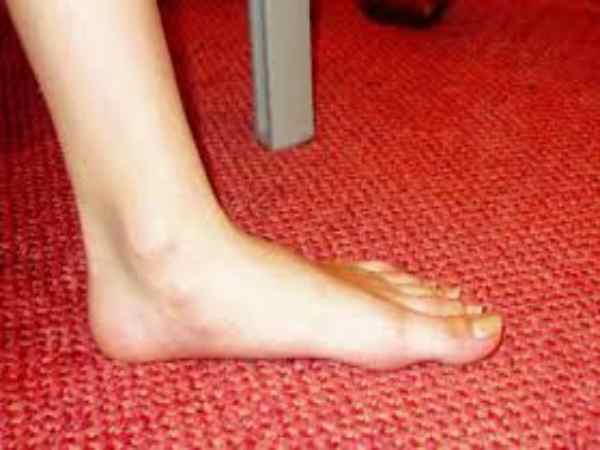 xem tướng bàn chân bằng phẳng