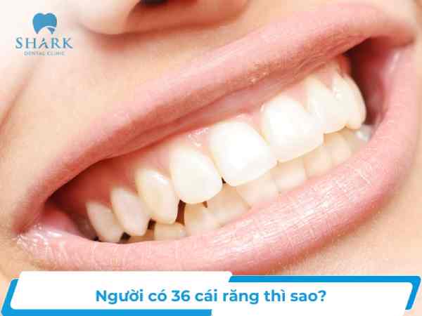 Xem tướng đoán tình duyên người răng hô