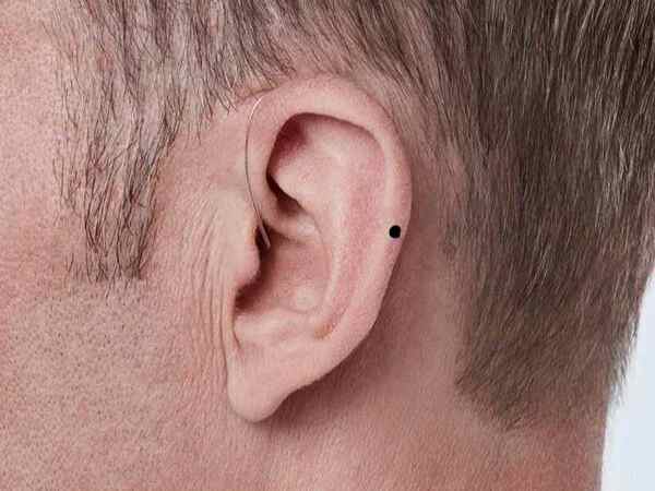nốt ruồi ở tai đàn ông