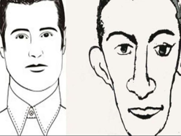 Mũi gãy, sống mũi lệch hoặc đầu mũi nhọn