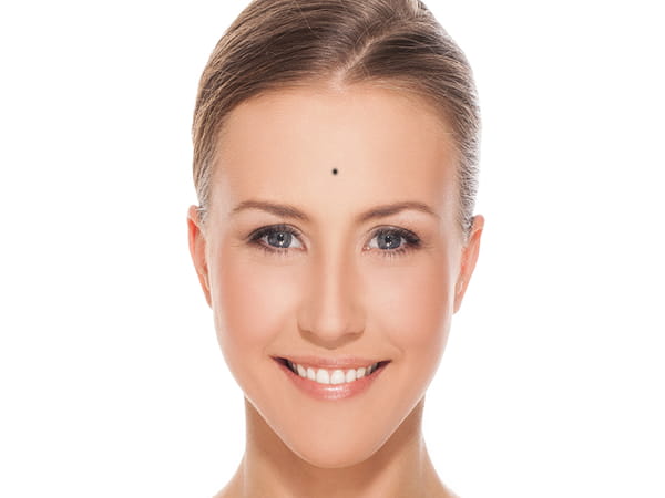 Nốt ruồi ở giữa trán