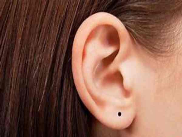 Ý nghĩa nốt ruồi ở dái tai Ý nghĩa nốt ruồi ở dái tai