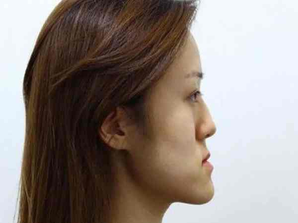 Mặt lưỡi cày là gì?