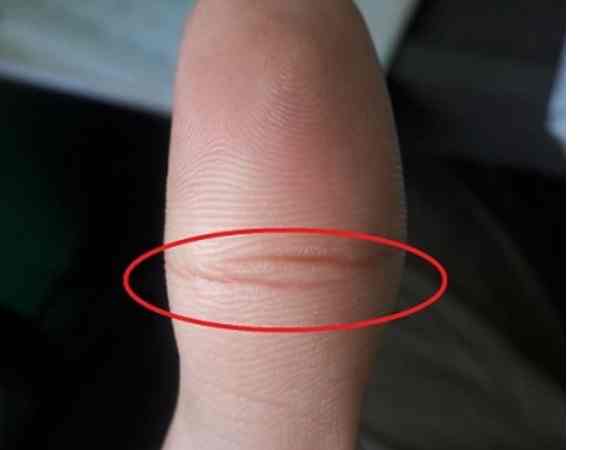 Vân tay mắt phượng là gì?