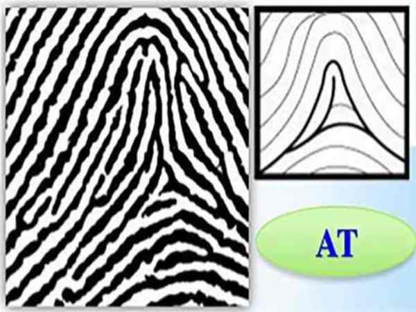 Chủng vân tay AT (Tented Arch) Chủng vân tay AT (Tented Arch)