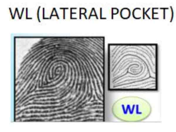 Chủng Wl – Lateral Pocket Whorl Chủng Wl – Lateral Pocket Whorl