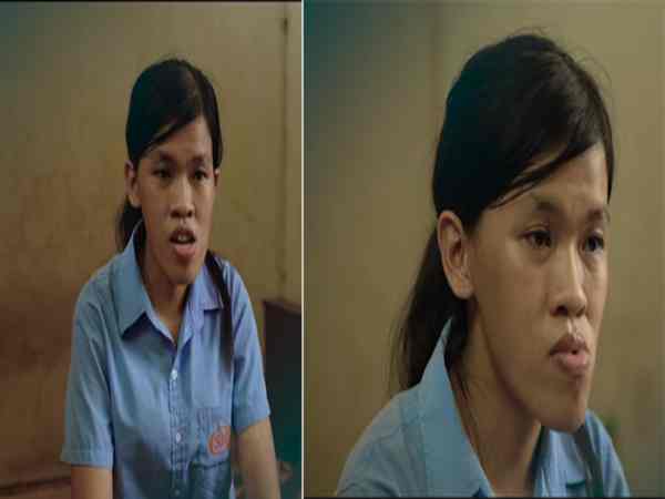 mặt lưỡi cày là gì