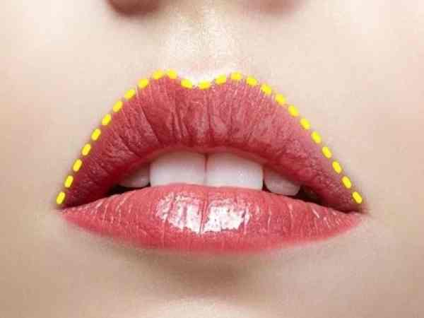 Môi cong là gì? Môi cong là gì?