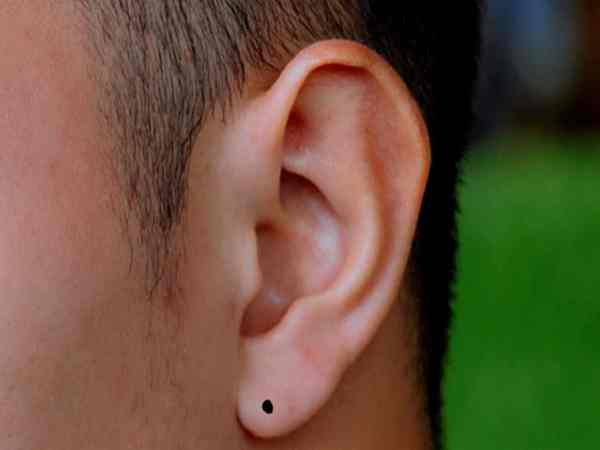 nốt ruồi ở dái tai