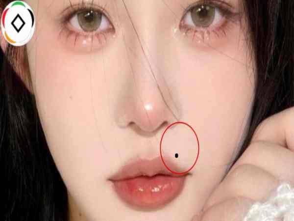 Phân tích nốt ruồi ở mép môi trên bên phải ở nam và nữ