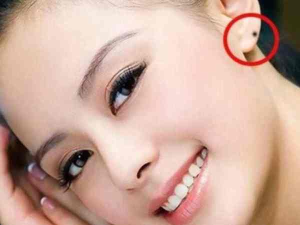 Nốt ruồi ở dái tai phải Nốt ruồi ở dái tai phải