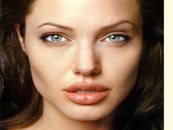 Tướng môi chẻ là gì?