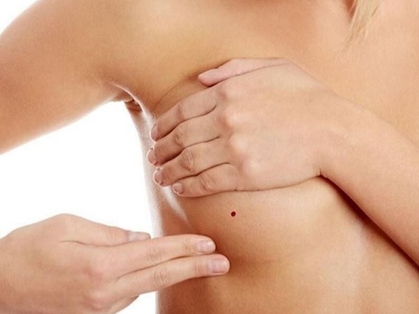 Ý nghĩa của nốt ruồi ở ngực phải
